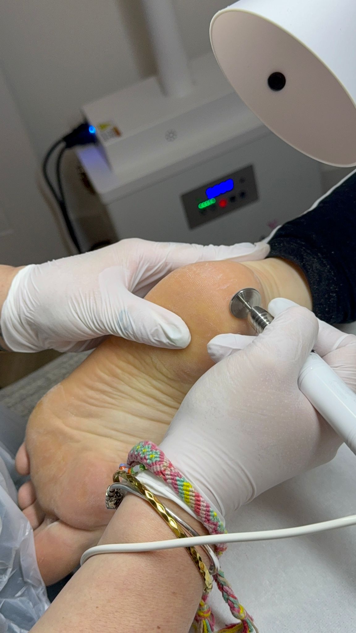 Rebecca carrying out a professional advanced heel treatment